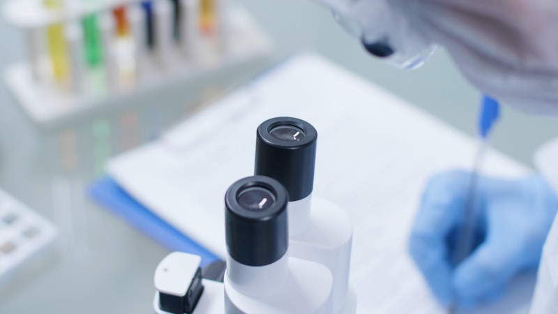 стадии фиброза печени