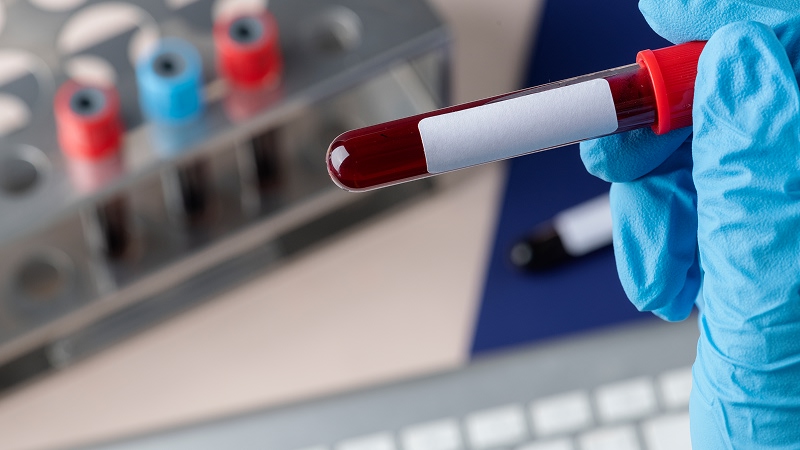 кровь в пробирке