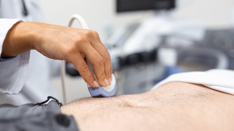 хронический цирроз печени