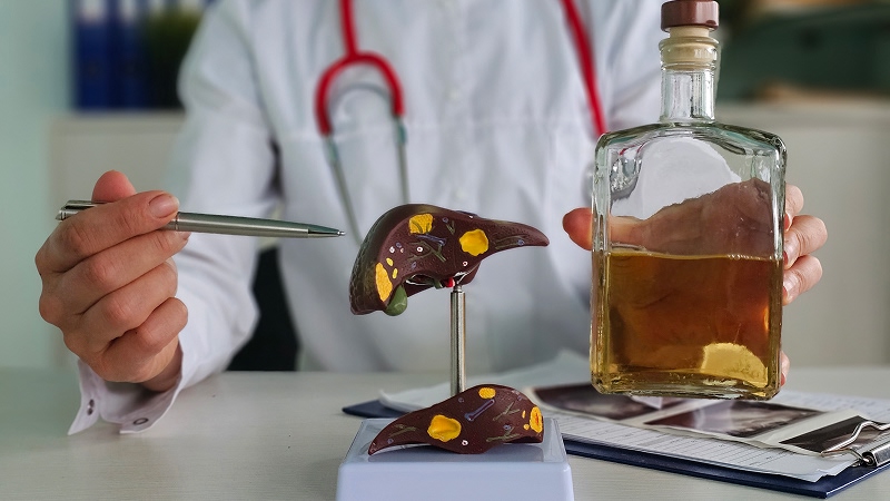 цирроз печени стадии